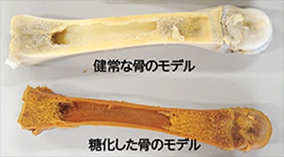 健常な骨のモデル / 糖化した骨のモデル