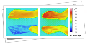 サーモグラフィー イメージ画像