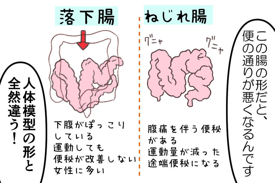 腸の形と運動不足