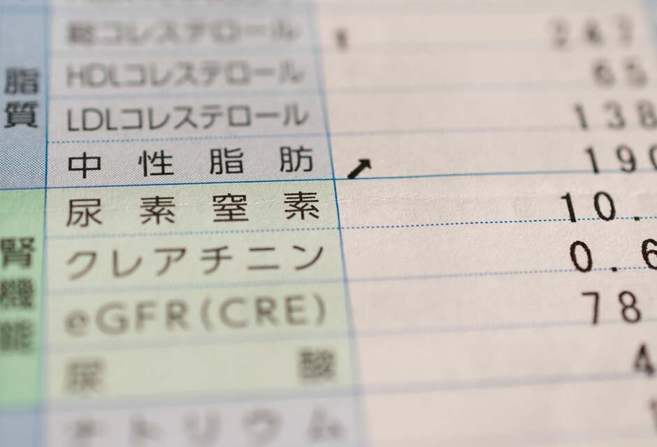 中性脂肪の基準値