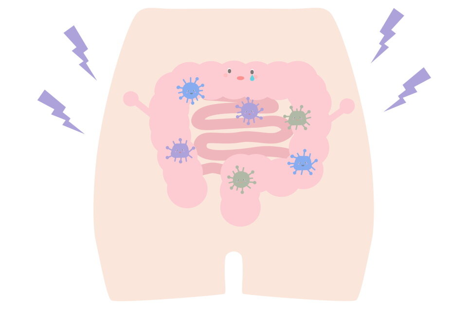 悪化した腸内環境