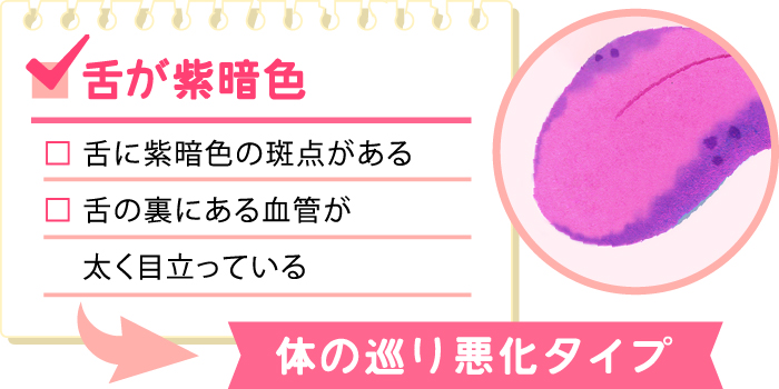 舌で健康状態をチェック 舌診断でわかる4つの不調タイプと改善方法 楽しむ 学ぶ 養命酒製造株式会社