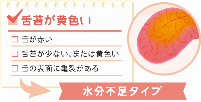 舌で健康状態をチェック 舌診断でわかる4つの不調タイプと改善方法 楽しむ 学ぶ 養命酒製造株式会社