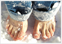 冷え性と体表温